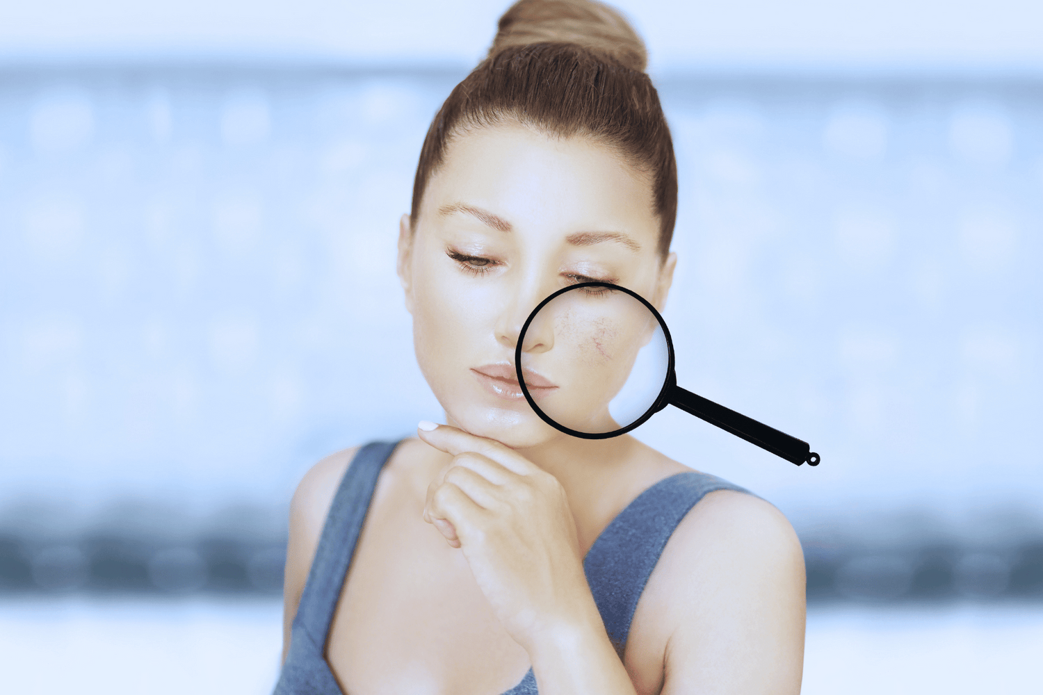 Dieta e Rosacea: un approccio integrato alla cura della pelle